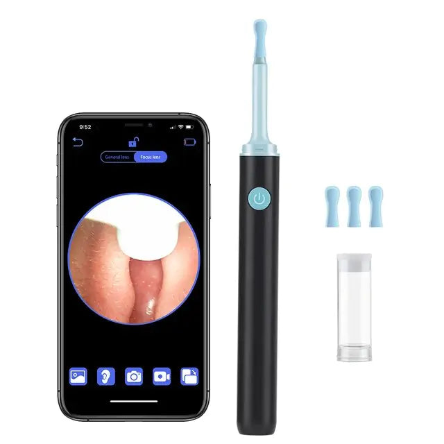 Smart Visual Ear Cleaner | Rowkoly